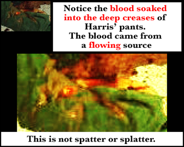 The creases in Harris' pants are blood-soaked